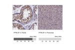 Immunohistochemistry analysis in human testis and pancreas tissues using HPA038902 antibody. Corresponding PPHLN1 RNA-seq data are presented for the same tissues.