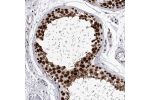 Immunohistochemical staining of human testis shows nuclear positivity in cells in seminiferous ducts.