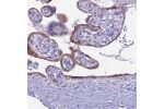 Immunohistochemical staining of human placenta shows moderate cytoplasmic positivity in trophoblastic cells.