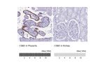 Immunohistochemistry analysis in human placenta and kidney tissues using HPA038934 antibody. Corresponding CGB3 RNA-seq data are presented for the same tissues.