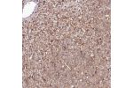Immunohistochemical staining of human pancreas shows strong cytoplasmic and membranous positivity in exocrine glandular cells.