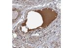Immunohistochemical staining of human soft tissue shows positivity in plasma.