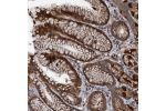 Immunohistochemical staining of human stomach shows strong cytoplasmic positivity in glandular cells.