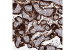 Immunohistochemical staining of human placenta shows strong cytoplasmic positivity in trophoblastic cells.