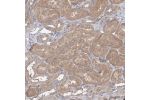 Immunohistochemical staining of human breast shows moderate cytoplasmic positivity in glandular cells.