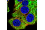 Immunofluorescent staining of human cell line MCF7 shows localization to cytosol.