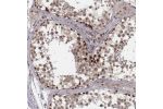 Immunohistochemical staining of human testis shows moderate to strong nuclear positivity in cells in seminiferous ducts.