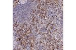 Immunohistochemical staining of human spleen shows moderate to strong membranous/ cytoplasmic positivity in cells in red pulp.