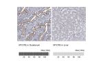 Immunohistochemistry analysis in human duodenum and liver tissues using Anti-MYO7B antibody. Corresponding MYO7B RNA-seq data are presented for the same tissues.