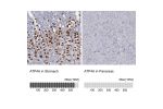 Immunohistochemistry analysis in human stomach and pancreas tissues using Anti-ATP4A antibody. Corresponding ATP4A RNA-seq data are presented for the same tissues.