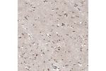 Immunohistochemical staining of human cerebral cortex shows moderate nuclear positivity in glial cells.