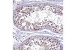 Immunohistochemical staining of human testis shows weak to moderate nuclear and cytoplasmic positivity in cells in seminiferous ducts.