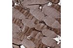 Immunohistochemical staining of human skeletal muscle shows strong cytoplasmic positivity in myocytes.