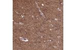 Immunohistochemical staining of human cerebral cortex shows strong cytoplasmic positivity in neuropil.