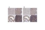 Immunohistochemical staining of human cerebral cortex, squamous epithelia, testis and tonsil using Anti-PSMD4 antibody HPA039252 (A) shows similar protein distribution across tissues to independent antibody HPA038807 (B).