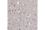 Immunohistochemical staining of human cerebral cortex shows moderate cytoplasmic positivity in neurons.