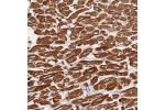 Immunohistochemical staining of human heart muscle shows strong cytoplasmic positivity in myocytes.