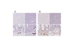 Immunohistochemical staining of human cerebral cortex, pancreas, rectum and upper gastrointestinal using Anti-PRPH antibody HPA039277 (A) shows similar protein distribution across tissues to independent antibody HPA063887 (B).