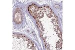 Immunohistochemical staining of human testis shows strong nuclear positivity in cells in seminiferous ducts.