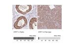 Immunohistochemistry analysis in human testis and pancreas tissues using Anti-STIP1 antibody. Corresponding STIP1 RNA-seq data are presented for the same tissues.