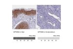 Immunohistochemistry analysis in human skin and endometrium tissues using Anti-SPTBN2 antibody. Corresponding SPTBN2 RNA-seq data are presented for the same tissues.