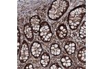 Immunohistochemical staining of human rectum shows very strong cytoplasmic positivity in glandular cells.