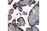Immunohistochemical staining of human placenta shows strong cytoplasmic positivity in trophoblastic cells.
