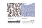 Immunohistochemistry analysis in human lung and skin tissues using HPA039325 antibody. Corresponding SDPR RNA-seq data are presented for the same tissues.