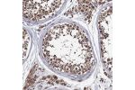 Immunohistochemical staining of human testis shows strong granular cytoplasmic positivity in Leydig cells and cells in seminiferous ducts.