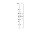 Western blot analysis in human cell line RT-4.