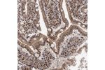 Immunohistochemical staining of human duodenum shows moderate cytoplasmic and nuclear positivity in glandular cells.