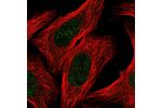Immunofluorescent staining of human cell line U-2 OS shows localization to nucleoplasm.
