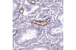 Immunohistochemical staining of human endometrium shows strong cytoplasmic positivity in endothelial cells.