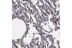 Immunohistochemical staining of human lung shows strong membranous positivity in respiratory epithelial cells.