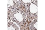 Immunohistochemical staining of human colon shows strong cytoplasmic and nuclear positivity in glandular cells.