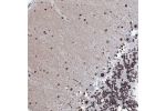 Immunohistochemical staining of human cerebellum shows strong nuclear positivity in purkinje cells.