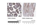 Immunohistochemistry analysis in human placenta and skeletal muscle tissues using HPA039494 antibody. Corresponding P2RX4 RNA-seq data are presented for the same tissues.