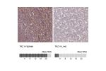 Immunohistochemistry analysis in human spleen and liver tissues using HPA039557 antibody. Corresponding TAZ RNA-seq data are presented for the same tissues.