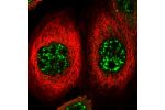 Immunofluorescent staining of human cell line A-431 shows localization to nuclear speckles & cytosol.