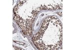 Immunohistochemical staining of human testis shows moderate cytoplasmic positivity in cells in seminiferous ducts.
