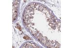 Immunohistochemical staining of human testis shows strong cytoplasmic positivity in cells in seminiferous ducts and Leydig cells.