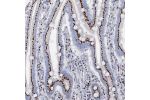 Immunohistochemical staining of human duodenum shows strong granular cytoplasmic positivity in glandular cells.