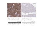 Immunohistochemistry analysis in human parathyroid gland and skeletal muscle tissues using HPA039686 antibody. Corresponding CASR RNA-seq data are presented for the same tissues.