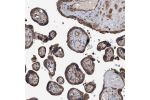 Immunohistochemical staining of human placenta shows strong cytoplasmic positivity in trophoblastic cells.
