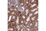 Immunohistochemical staining of human kidney shows strong cytoplasmic positivity in cells in tubules.