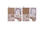 Immunohistochemical staining of human cerebral cortex, colon, kidney and testis using Anti-DCTN2 antibody HPA039715 (A) shows similar protein distribution across tissues to independent antibody HPA040040 (B).