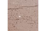 Immunohistochemical staining of human skeletal muscle shows strong cytoplasmic positivity in myocytes.