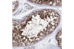 Immunohistochemical staining of human testis shows strong cytoplasmic positivity in cells in seminiferus ducts.