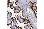 Immunohistochemical staining of human placenta shows strong cytoplasmic positivity in trophoblastic cells.