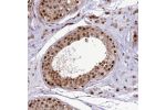 Immunohistochemical staining of human testis shows strong nuclear positivity in cells in seminiferous ducts.
